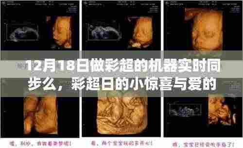 彩超日惊喜与爱的传递,机器实时同步揭秘