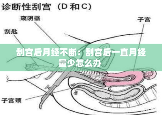 刮宫后月经不断:刮宫后一直月经量少怎么办