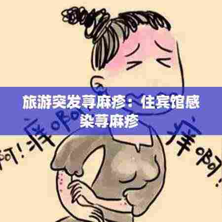 旅游突发荨麻疹：住宾馆感染荨麻疹 