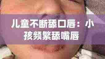 儿童不断舔口唇:小孩频繁舔嘴唇
