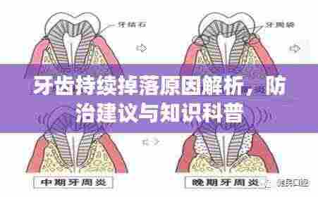 牙齿持续掉落原因解析，防治建议与知识科普